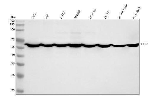 Anti-TCP1 beta Rabbit Monoclonal Antibody Boster Bio