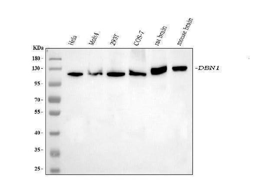 Anti-Drebrin/DBN1 Antibody Picoband® (monoclonal, 4F6E7 Boster Bio
