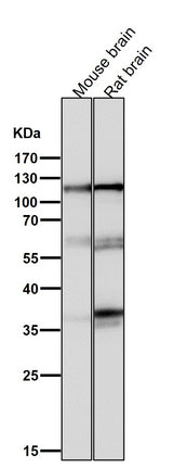 Anti-Drebrin DBN1 Rabbit Monoclonal Antibody Boster Bio