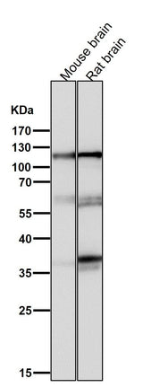 Anti-Drebrin DBN1 Rabbit Monoclonal Antibody Boster Bio