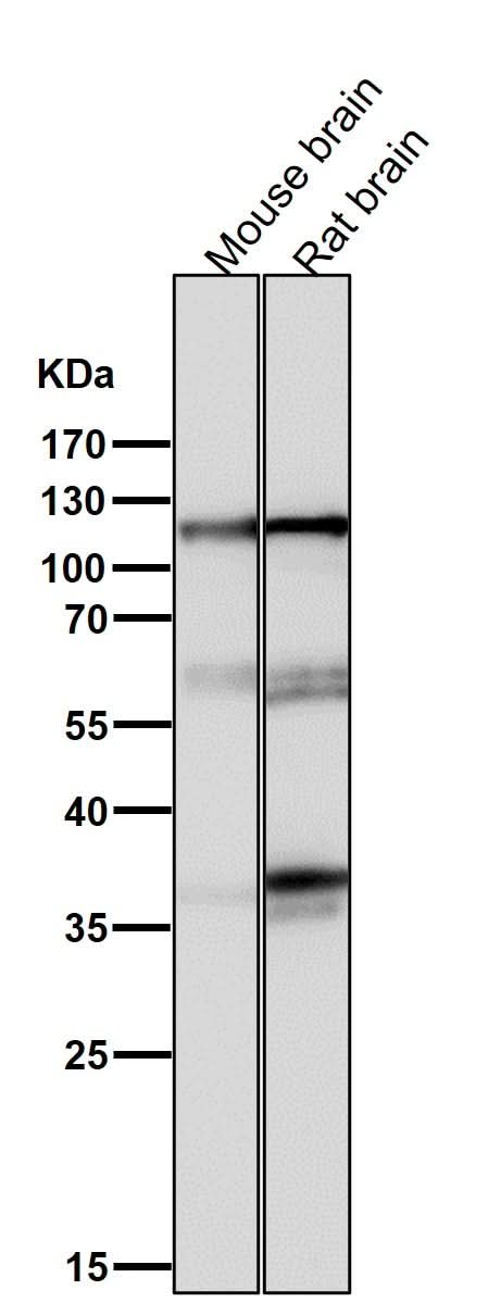 Anti-Drebrin DBN1 Rabbit Monoclonal Antibody Boster Bio