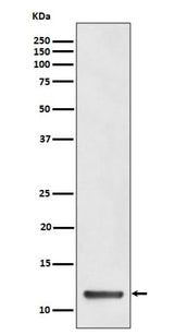 Anti-TCTEX1 Rabbit Monoclonal Antibody Boster Bio