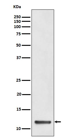 Anti-TCTEX1 Rabbit Monoclonal Antibody Boster Bio
