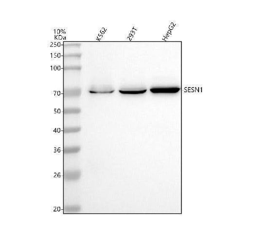 Anti-SESN1 Rabbit Monoclonal Antibody Boster Bio
