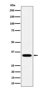 Anti-PPCS Rabbit Monoclonal Antibody Boster Bio