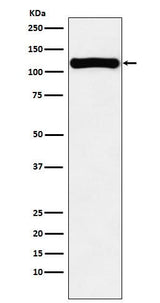 Anti-VPS11 Rabbit Monoclonal Antibody Boster Bio