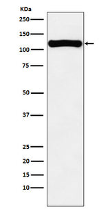 Anti-VPS11 Rabbit Monoclonal Antibody Boster Bio