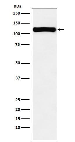 Anti-VPS11 Rabbit Monoclonal Antibody Boster Bio