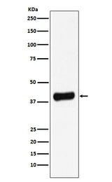 Anti-Galectin 8 Rabbit Monoclonal Antibody Boster Bio
