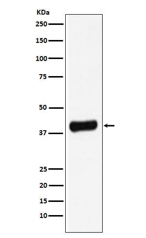 Anti-Galectin 8 Rabbit Monoclonal Antibody Boster Bio