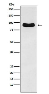 Anti-Cenexin1 / ODF2 Rabbit Monoclonal Antibody Boster Bio
