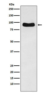 Anti-Cenexin1 / ODF2 Rabbit Monoclonal Antibody Boster Bio