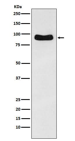 Anti-Cenexin1 / ODF2 Rabbit Monoclonal Antibody Boster Bio