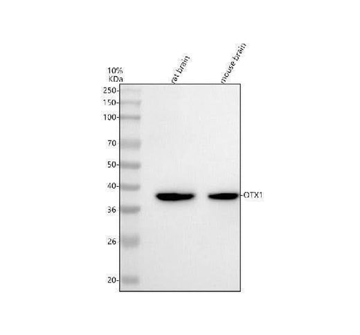 Anti-Otx1 Rabbit Monoclonal Antibody Boster Bio
