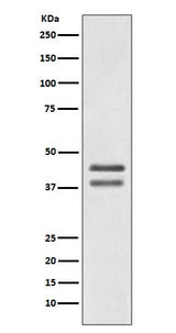 Anti-JunD Rabbit Monoclonal Antibody Boster Bio