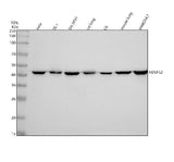Anti-NDUFS2 Rabbit Monoclonal Antibody Boster Bio