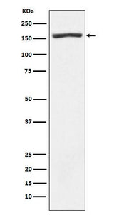 Anti-Nidogen 1 Rabbit Monoclonal Antibody Boster Bio