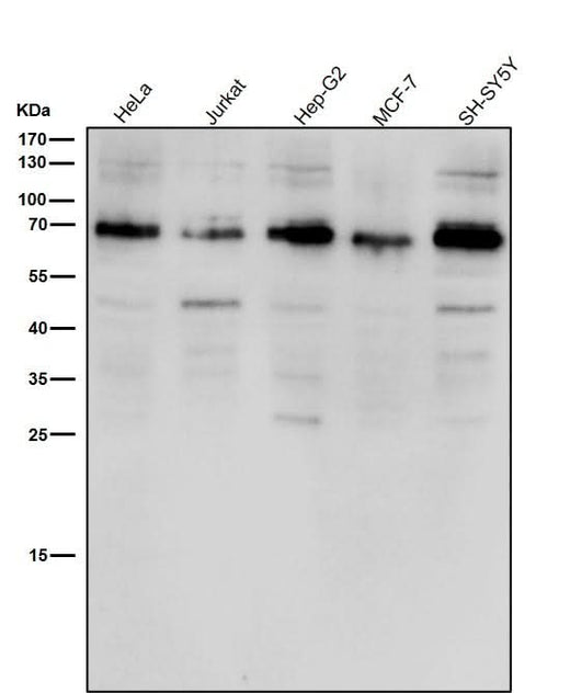Anti-ACBD3 Rabbit Monoclonal Antibody Boster Bio