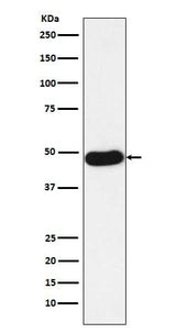 Anti-Napsin A NAPSA Monoclonal Antibody Boster Bio