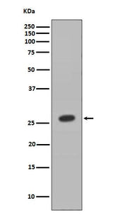 Anti-HOXB9 Rabbit Monoclonal Antibody Boster Bio