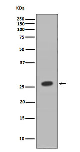Anti-HOXB9 Rabbit Monoclonal Antibody Boster Bio