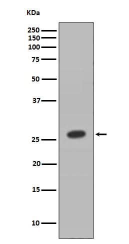 Anti-HOXB9 Rabbit Monoclonal Antibody Boster Bio