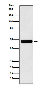 Anti-HSC70 Interacting Protein HIP Rabbit Monoclonal Antibody Boster Bio