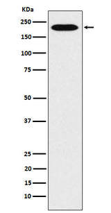 Anti-RhoGAP Rabbit Monoclonal Antibody Boster Bio