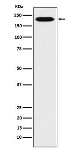 Anti-RhoGAP Rabbit Monoclonal Antibody Boster Bio