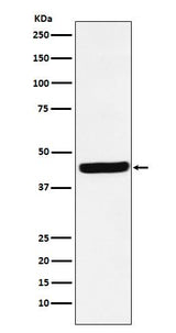 Anti-AHA1 Rabbit Monoclonal Antibody Boster Bio