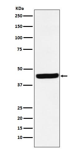 Anti-AHA1 Rabbit Monoclonal Antibody Boster Bio