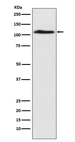 Anti-CHD1L Rabbit Monoclonal Antibody Boster Bio