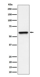 Anti-RGS6 Rabbit Monoclonal Antibody Boster Bio