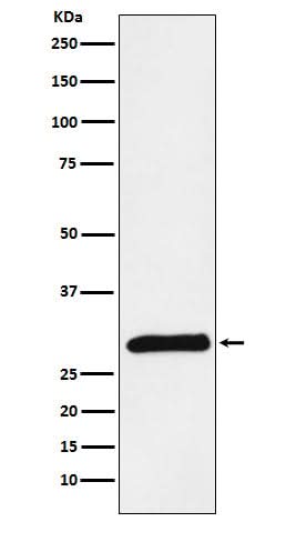 Anti-PRSS2 Rabbit Monoclonal Antibody Boster Bio