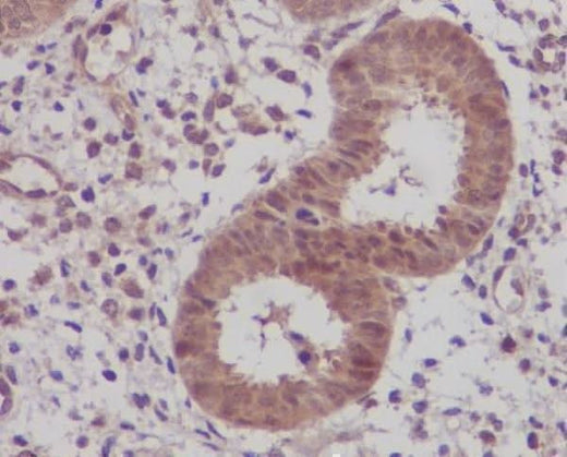 Anti-IKB beta Rabbit Monoclonal Antibody Boster Bio
