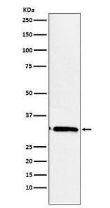 Anti-EB3 Rabbit Monoclonal Antibody Boster Bio