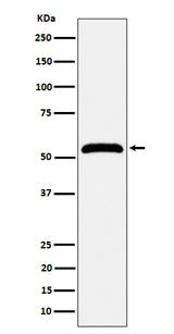Anti-MPP1 Rabbit Monoclonal Antibody Boster Bio