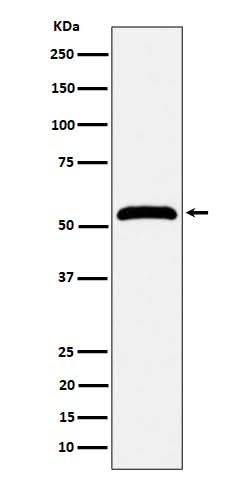 Anti-MPP1 Rabbit Monoclonal Antibody Boster Bio