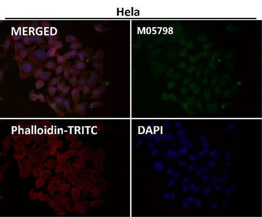 Anti-Cdc23/APC8 Rabbit Monoclonal Antibody Boster Bio