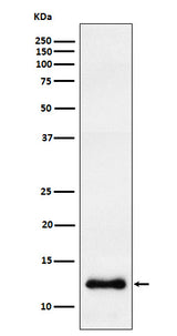Anti-CCL23 Rabbit Monoclonal Antibody Boster Bio
