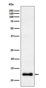 Anti-CCL23 Rabbit Monoclonal Antibody Boster Bio
