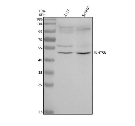 Anti-Wnt5b Rabbit Monoclonal Antibody Boster Bio