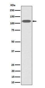Anti-ZHX2 Rabbit Monoclonal Antibody Boster Bio