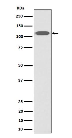 Anti-ZHX2 Rabbit Monoclonal Antibody Boster Bio