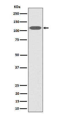 Anti-ZHX2 Rabbit Monoclonal Antibody Boster Bio
