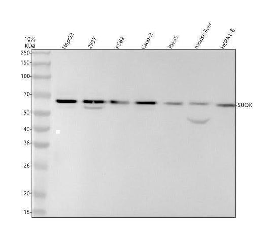 Anti-SUOX Rabbit Monoclonal Antibody Boster Bio