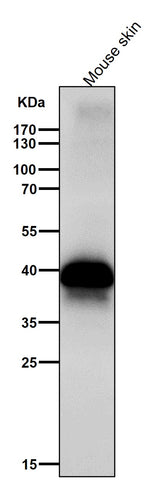Anti-DLX3 Rabbit Monoclonal Antibody Boster Bio