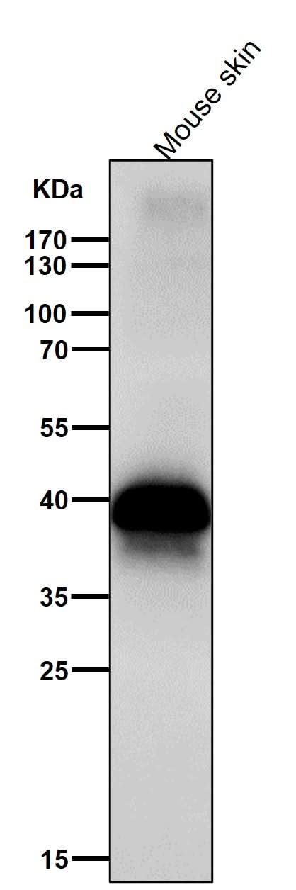 Anti-DLX3 Rabbit Monoclonal Antibody Boster Bio