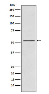 Anti-P70 S6 Kinase beta Rabbit Monoclonal Antibody Boster Bio