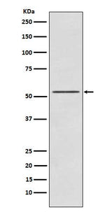 Anti-P70 S6 Kinase beta Rabbit Monoclonal Antibody Boster Bio